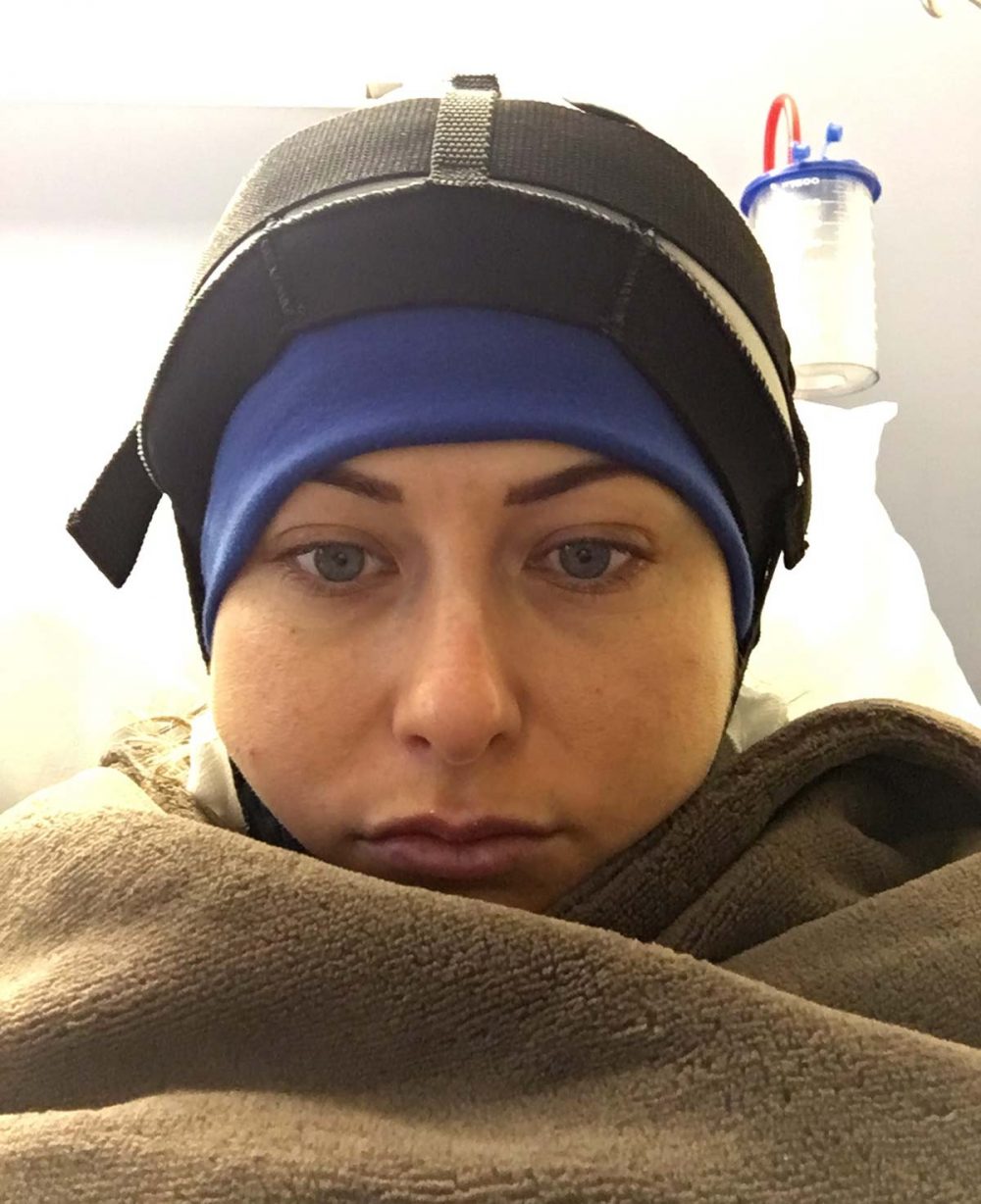 Cold Cap Hair Loss Sammy Jo Brandon Foundation